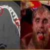 Jake Paul Gives Update on Double Broken Jaw and When He’ll Fight Again
